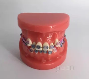Медицинские научные модели зубов Неправильная верхнечелюстная ортодонтическая модель Модель обучения полости рта наполовину металлическая, наполовину керамическая